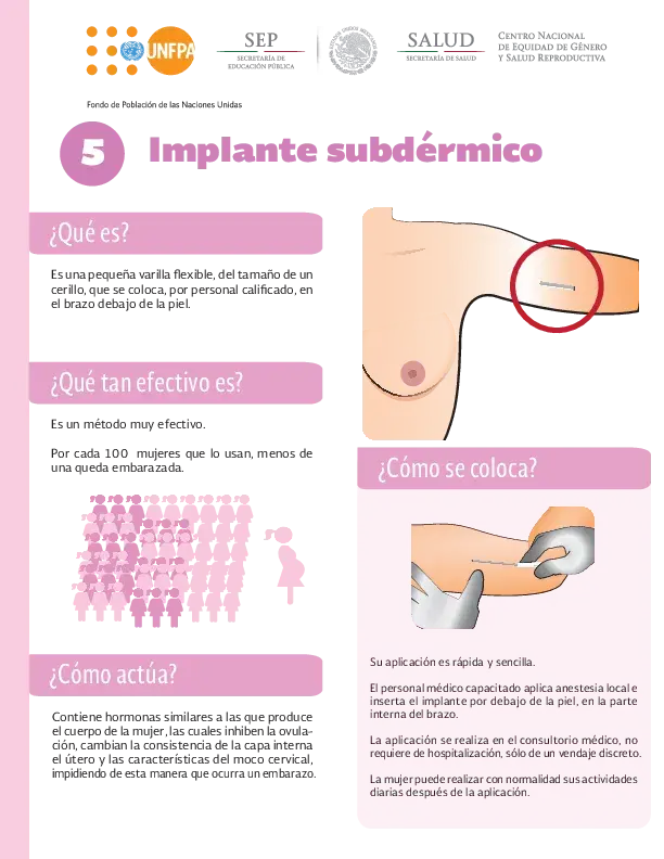 Infografía del Implante Subdérmico